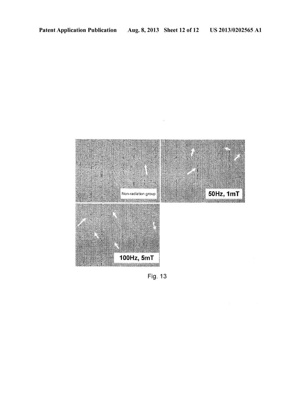 METHOD FOR INDUCING DIFFERENTIATION OF ADULT STEM CELLS AND NERVE CELLS     USING ELECTROMAGNETIC FIELD - diagram, schematic, and image 13