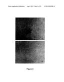 Use Of 2,5-Dihydroxybenzene Derivatives For Treating Actinic Keratosis diagram and image