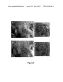 Use Of 2,5-Dihydroxybenzene Derivatives For Treating Actinic Keratosis diagram and image