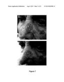 Use Of 2,5-Dihydroxybenzene Derivatives For Treating Actinic Keratosis diagram and image