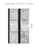 IMMUNOGENIC COMPOSITIONS AGAINST TUBERCULOSIS diagram and image