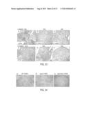 IMMUNOGENIC COMPOSITIONS AGAINST TUBERCULOSIS diagram and image