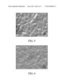 Dendrite-Inhibiting Salts in Electrolytes of Energy Storage Devices diagram and image