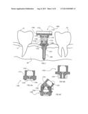 DENTAL REGISTRATION DEVICE AND METHOD diagram and image