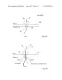 HYBRID NANOPORE DEVICE WITH OPTICAL DETECTION AND METHODS OF USING SAME diagram and image