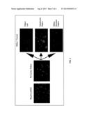 METHODS FOR IMPROVING INFLAMMATORY BOWEL DISEASE DIAGNOSIS diagram and image