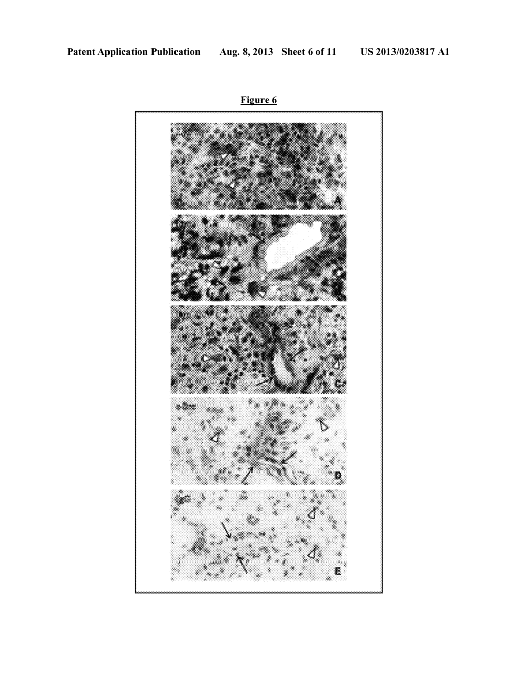 Novel Inhibitors of LYN Kinase - diagram, schematic, and image 07