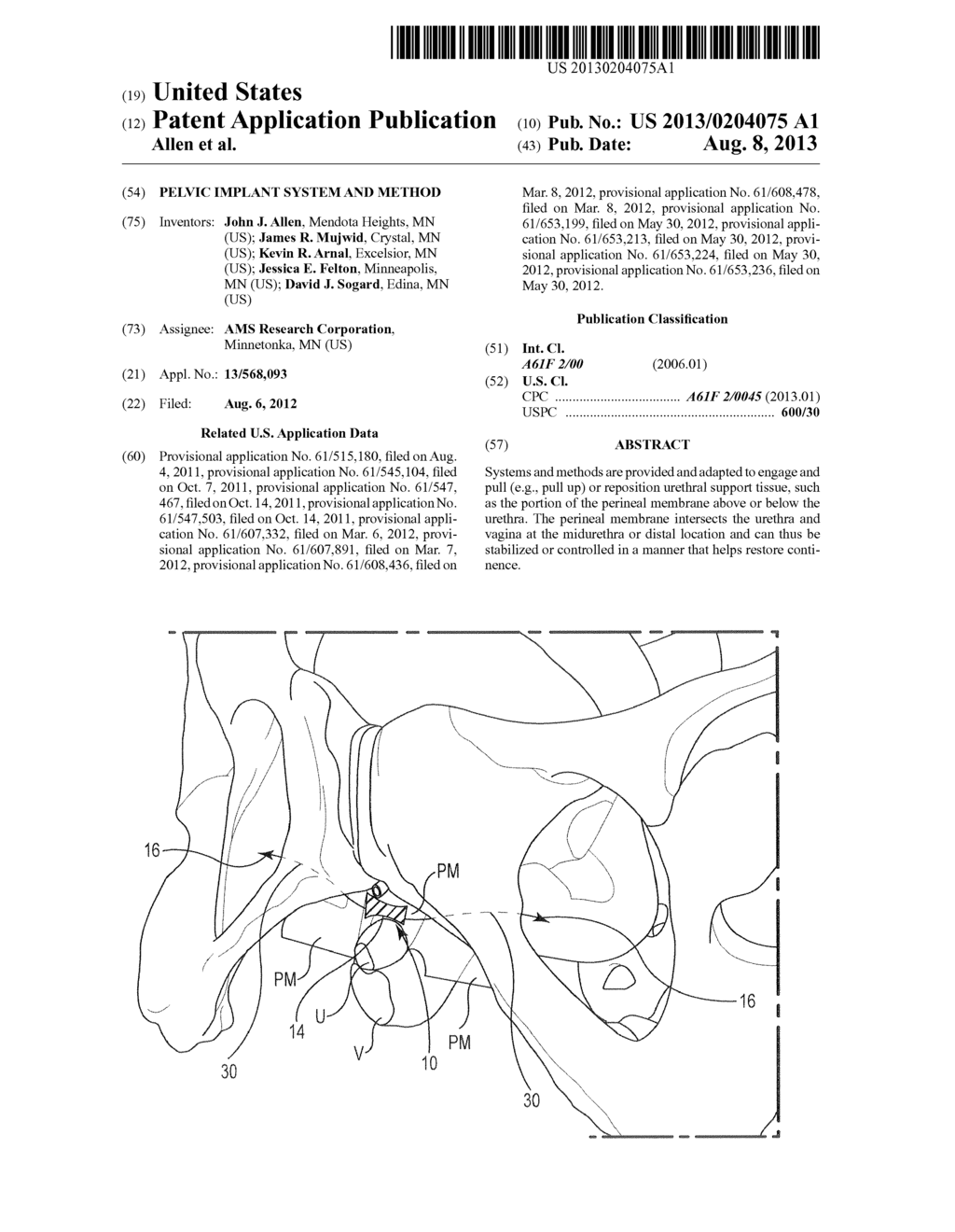 Pelvic Implant System and Method - diagram, schematic, and image 01