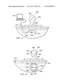 SYSTEM AND METHOD FOR A MAGNETIC ENDOSCOPE diagram and image