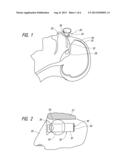 SOFT TISSUE SHIELD FOR TRANS-ORBITAL SURGERY diagram and image