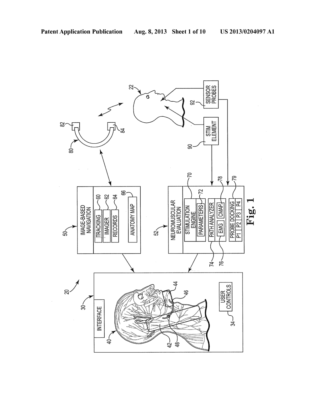 METHOD AND SYSTEM FOR IDENTIFYING A LOCATION FOR NERVE STIMULATION - diagram, schematic, and image 02