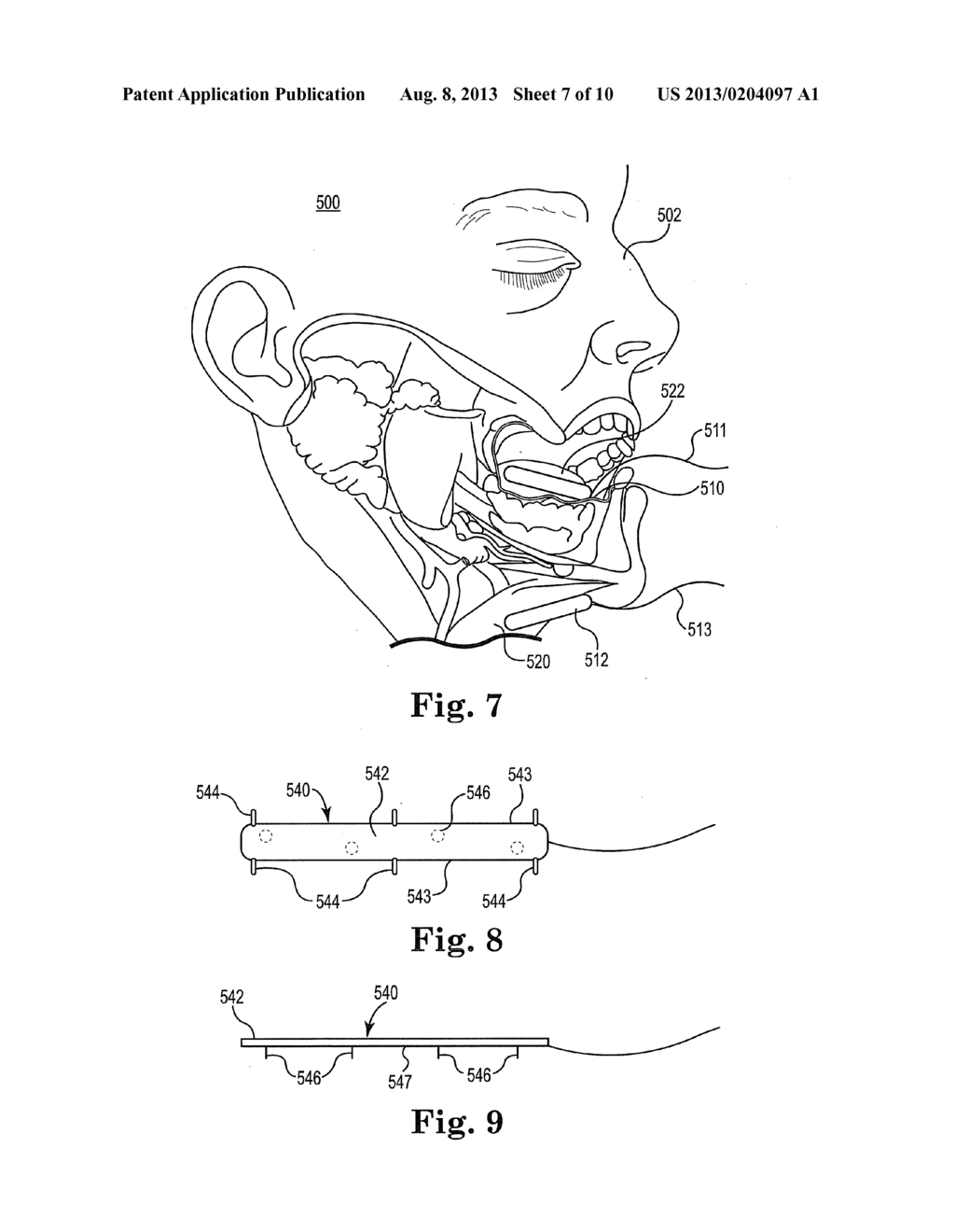 METHOD AND SYSTEM FOR IDENTIFYING A LOCATION FOR NERVE STIMULATION - diagram, schematic, and image 08