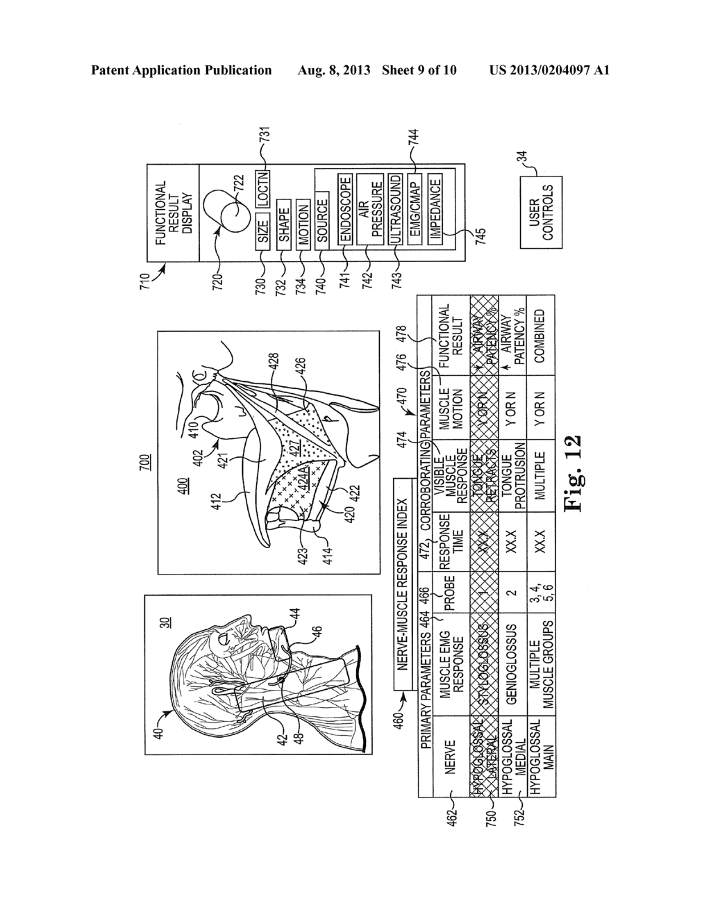 METHOD AND SYSTEM FOR IDENTIFYING A LOCATION FOR NERVE STIMULATION - diagram, schematic, and image 10