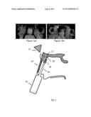 EQUIPMENT AND METHODOLOGIES FOR MAGNETICALLY-ASSISTED DELIVERY OF     THERAPEUTIC AGENTS THROUGH BARRIERS diagram and image