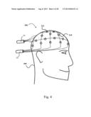 DEVICE FOR USE IN ELECTRO-BIOLOGICAL SIGNAL MEASUREMENT IN THE PRESENCE OF     A MAGNETIC FIELD diagram and image