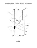 IMAGING SYSTEM PRODUCING MULTIPLE REGISTERED IMAGES OF A BODY LUMEN diagram and image