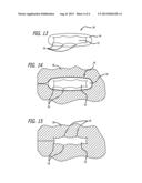 TARGET IDENTIFICATION TOOL FOR INTRA-BODY LOCALIZATION diagram and image