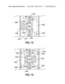 Arteriovenous Shunt Having a Moveable Valve diagram and image