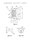 Arteriovenous Shunt Having a Moveable Valve diagram and image