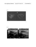 DUAL-MODAL IMAGING-GUIDED DRUG VEHICLE WITH ULTRASOUND-TRIGGERED RELEASE     FUNCTION diagram and image