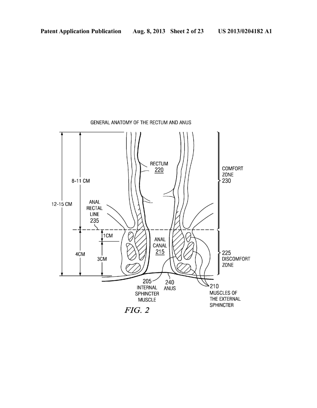 METHOD AND APPARATUS FOR INSERTING A RECTAL SUPPOSITORY - diagram, schematic, and image 03