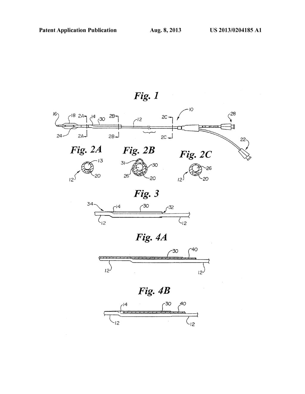 FLUID INJECTABLE SINGLE OPERATOR EXCHANGE CATHETERS AND METHODS OF USE - diagram, schematic, and image 02