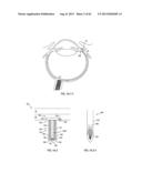 Posterior Segment Drug Delivery diagram and image