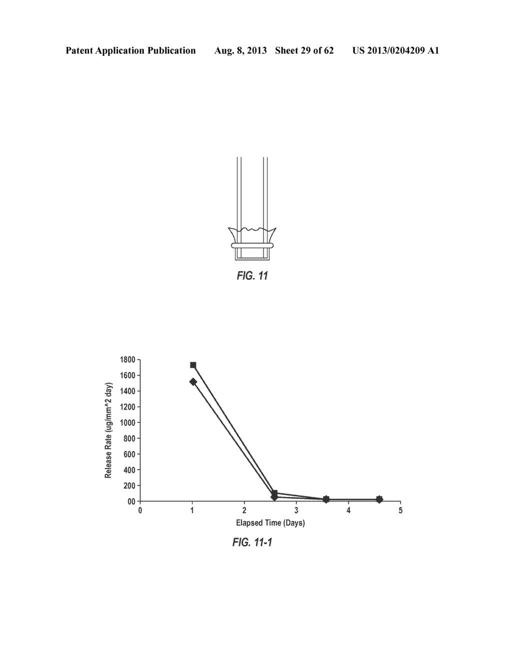 Posterior Segment Drug Delivery - diagram, schematic, and image 30