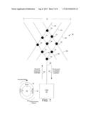 Expandable Catheter diagram and image