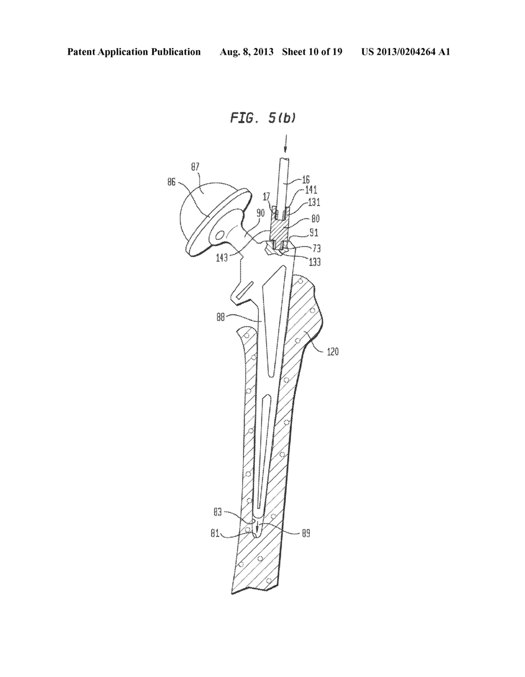 Pneumatic Surgical Instrument and Corresponding Methods for Implanting     Orthopedic Implants in Bone - diagram, schematic, and image 11