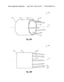 METHODS, DEVICES AND APPARATUS FOR PERFORMING A VASCULAR ANASTOMOSIS diagram and image