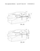 Soft Tissue Repair Device And Associated Methods diagram and image