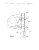 Soft Tissue Repair Device And Associated Methods diagram and image