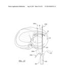 Soft Tissue Repair Device And Associated Methods diagram and image