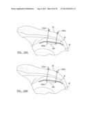 Soft Tissue Repair Device And Associated Methods diagram and image