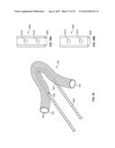 Soft Tissue Repair Device And Associated Methods diagram and image