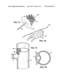 SYSTEMS FOR REMOVAL OF ATHEROSCLEROTIC PLAQUE OR THROMBUS AT A TREATMENT     SITE diagram and image