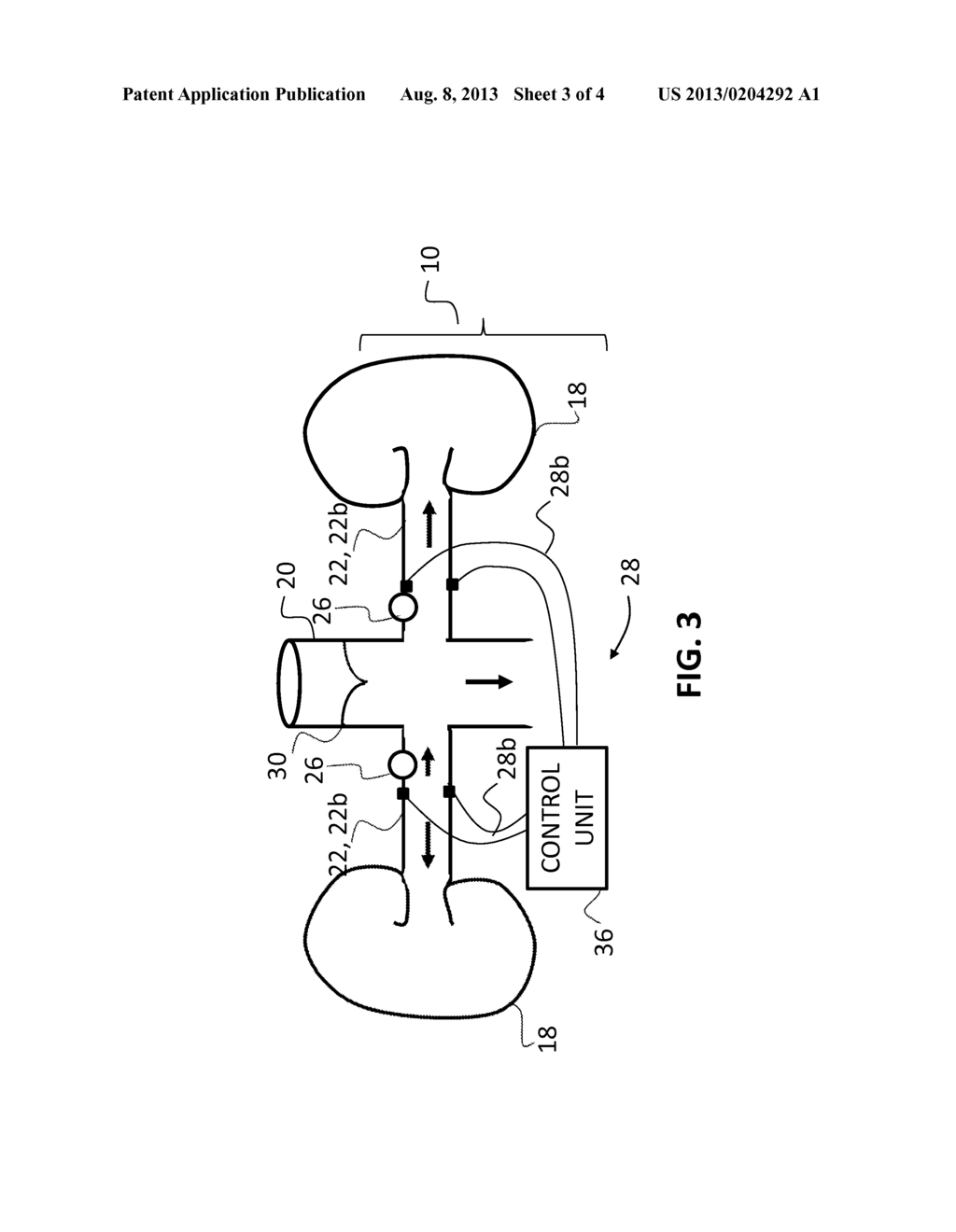 PRESSURE-ENHANCED BLOOD FLOW TREATMENT - diagram, schematic, and image 04