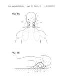 ACUPRESSURE APPLIANCE diagram and image