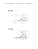 ACUPRESSURE APPLIANCE diagram and image