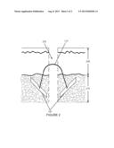 Absorbable Suture Device diagram and image