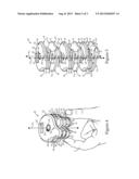 RELEASABLE SUTURE CLAMP AND SUTURE ANCHOR ASSEMBLY INCLUDING SAME diagram and image