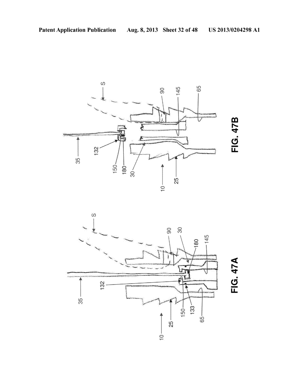 METHOD AND APPARATUS FOR ATTACHING TISSUE TO BONE, INCLUDING THE PROVISION     AND USE OF A NOVEL KNOTLESS SUTURE ANCHOR SYSTEM - diagram, schematic, and image 33