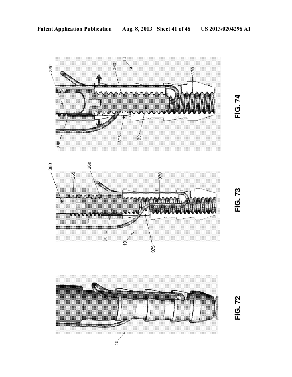 METHOD AND APPARATUS FOR ATTACHING TISSUE TO BONE, INCLUDING THE PROVISION     AND USE OF A NOVEL KNOTLESS SUTURE ANCHOR SYSTEM - diagram, schematic, and image 42