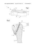 FIXING DEVICE FOR SUTURE THREADS TO BE INSERTED INTO A BONE TISSUE diagram and image