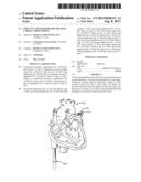 IMPLANTS AND METHODS FOR TREATING CARDIAC ARRHYTHMIAS diagram and image