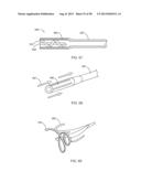 IMPLANTS AND METHODS FOR TREATING CARDIAC ARRHYTHMIAS diagram and image