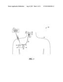 CONTROL OF NEURAL MODULATION THERAPY USING CERVICAL IMPEDANCE diagram and image