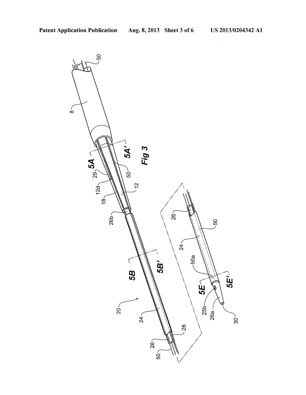 ORIENTATION MARKERS FOR ENDOVASCULAR DELIVERY SYSTEM - diagram, schematic, and image 04