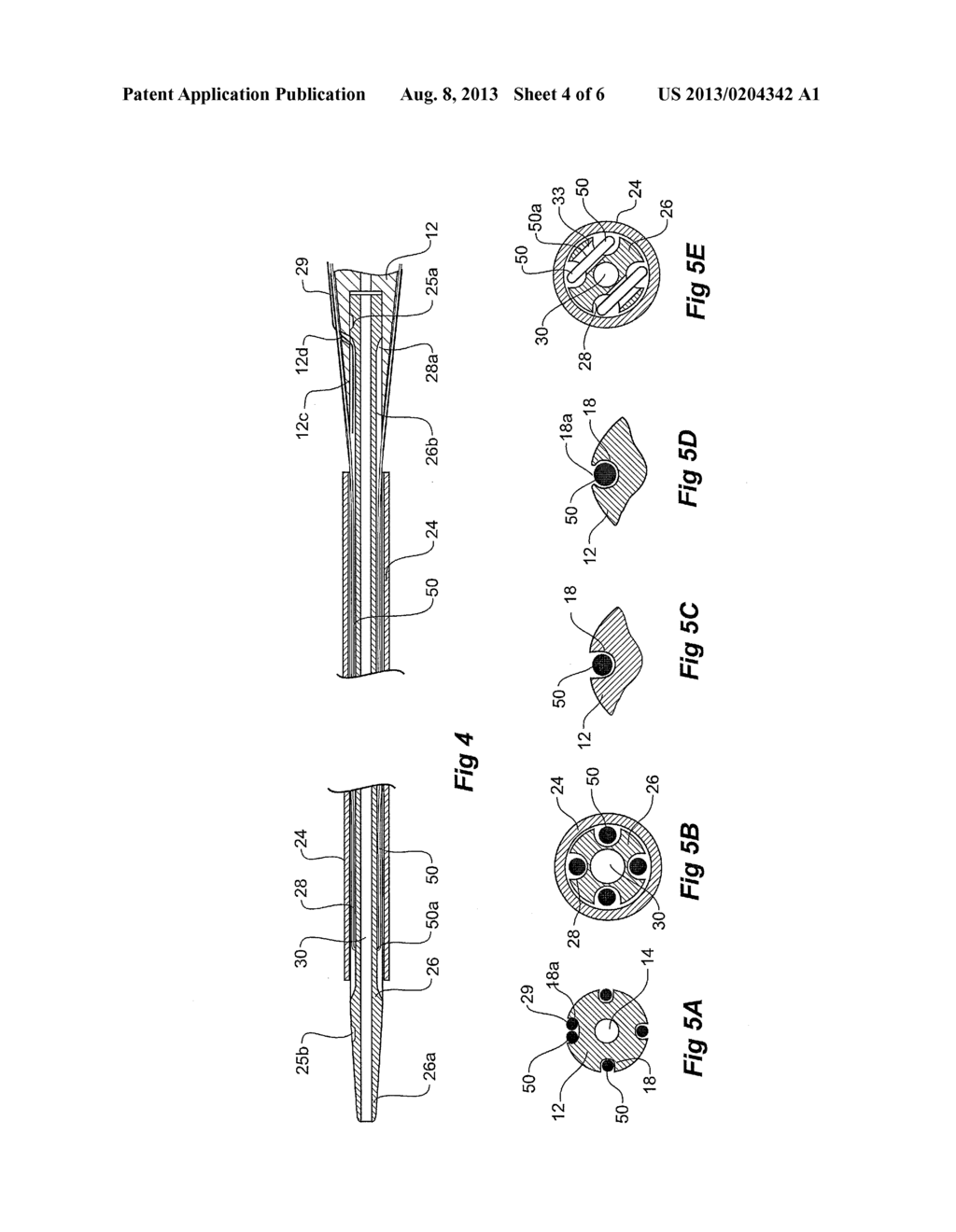 ORIENTATION MARKERS FOR ENDOVASCULAR DELIVERY SYSTEM - diagram, schematic, and image 05